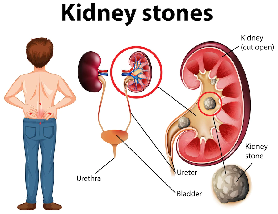 difference-between-kidney-and-gallbladder-amar-hospital