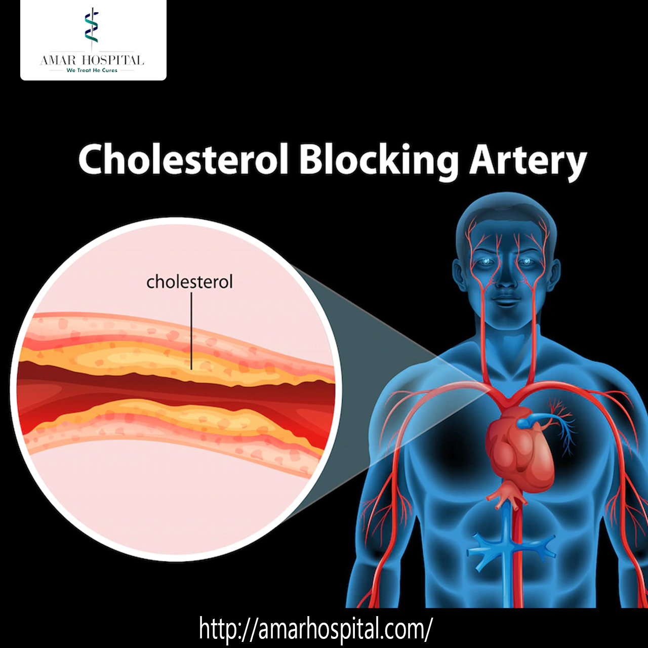 treatment-for-heart-attack-amar-hospital