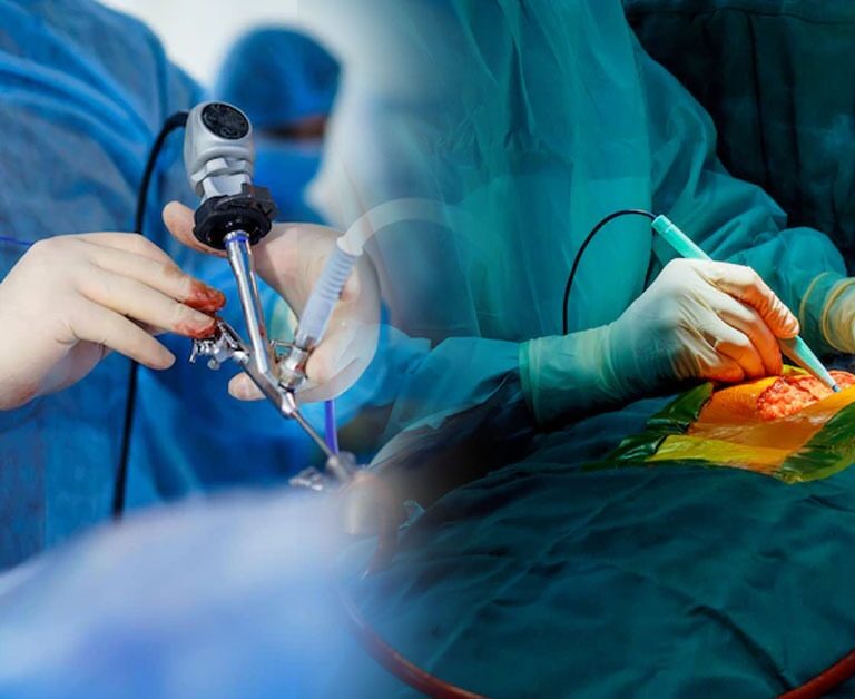 Minimally Invasive Heart Surgery