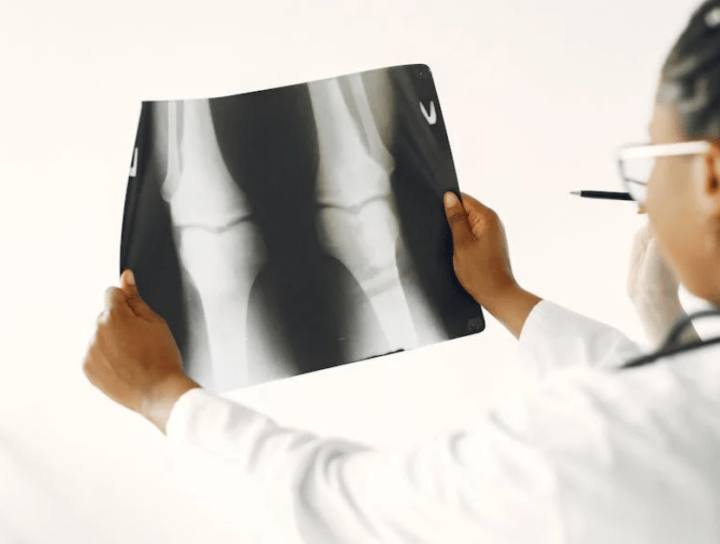 orthopedic doctor in Patiala